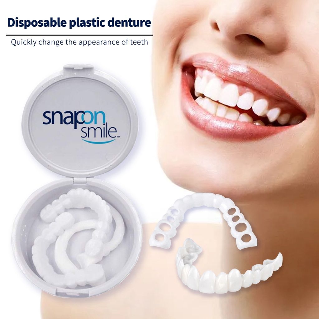 Snap-On Smile